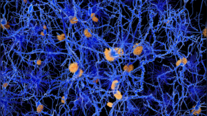 Stress and Your Lymphatic System: Unveiling the 4 Ways Chronic Stress Disrupts Detoxification and Immunity