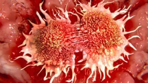 Vitamin C Deficiency Linked to Higher Risk of Stomach, Esophageal, and Lung Cancers: Know the Symptoms